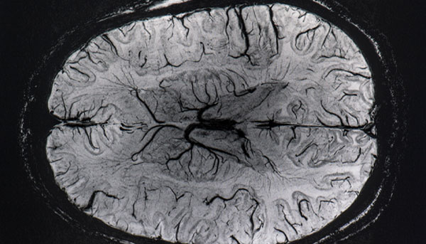 Brain Scan picture